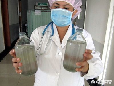 都说环境污染严重的城市人肺会变黑，肺里的脏东西可以洗出来吗？