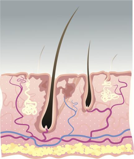 头屑小块但是很多头也很痒,头油头屑多头痒是什么原因