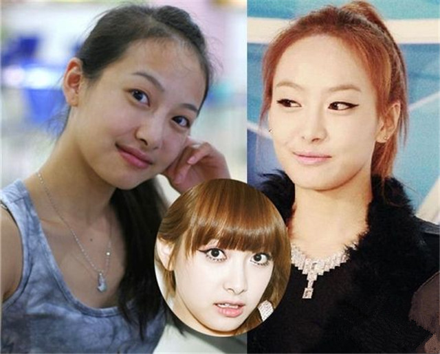 脑门大的露额头显得头大!来学学明星是如何解决的!