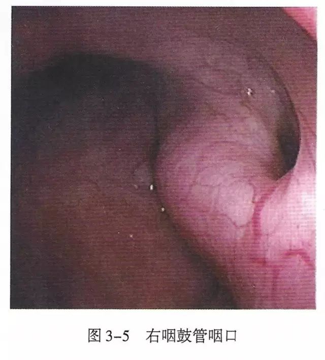 下呼吸道详细图解,必备上呼吸道解剖详解