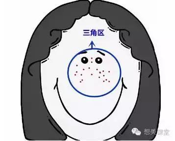 脸再美妆再浓，一颗痘痘毁你容！