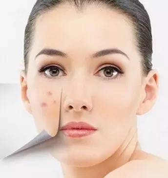 妖魔闭口猖獗的季节，打响毛孔大作战！