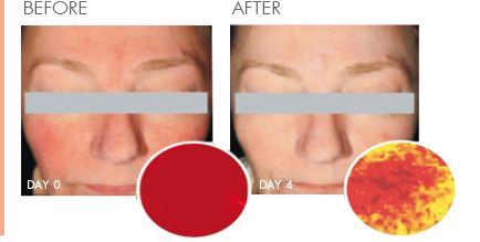 法国药妆真的有用吗,法国药妆有哪几款