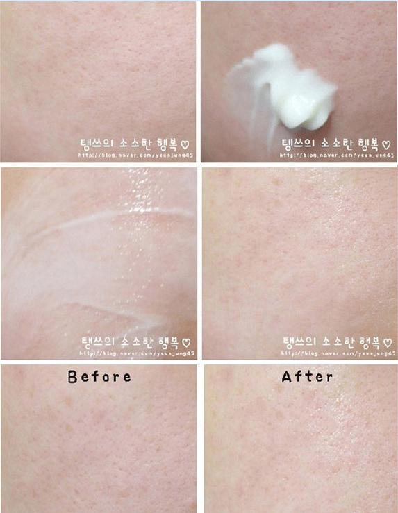 蜗牛修护霜适合什么皮肤,补水修护蜗牛霜