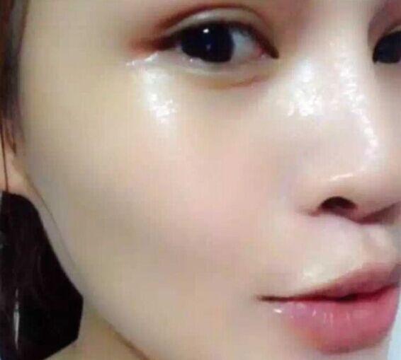 很多人不知道，五毛钱淡斑法，告别“斑女郎”肌肤雪嫩细滑如水