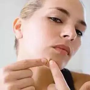 痘痘里面挤出来的白色东西是什么,闭合性粉刺挤出来白色有臭味