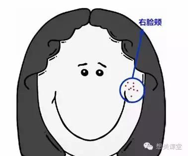 脸再美妆再浓，一颗痘痘毁你容！