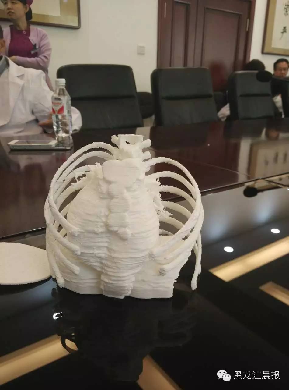 心脏长在肚子里的小女孩做手术,女孩心脏长在肚子上怎么办