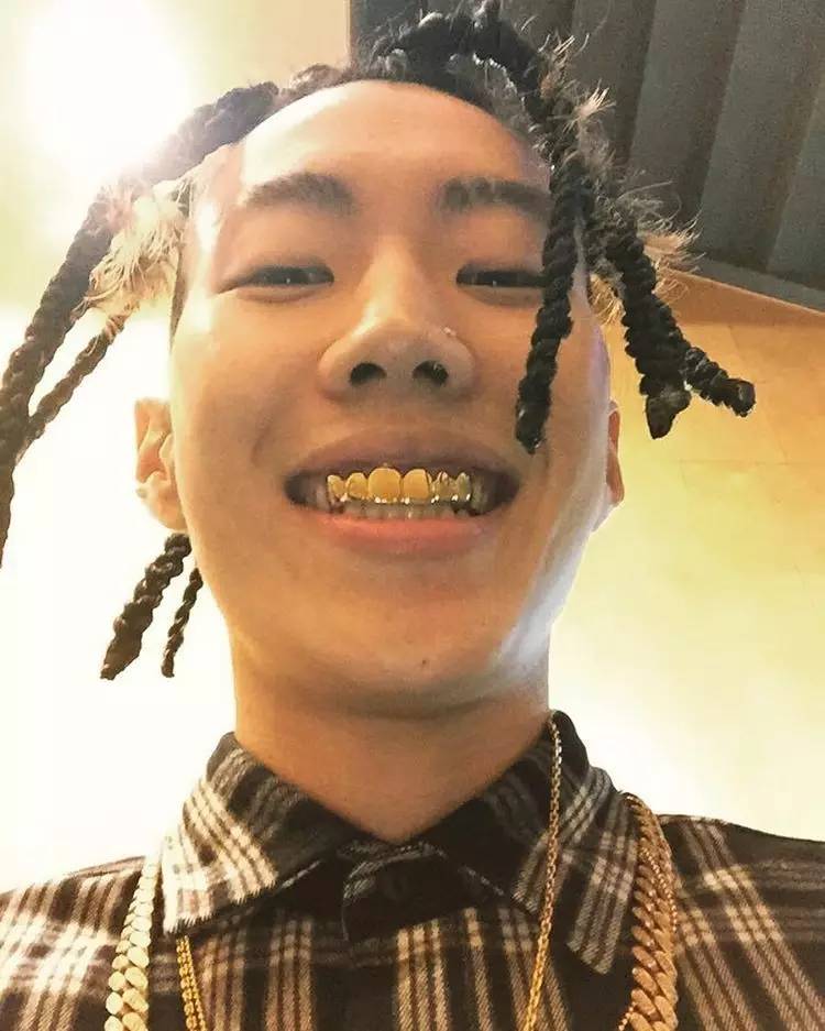 关于最近超火的金牙,你要知道这4件事(起码要知道怎么戴上去吧)