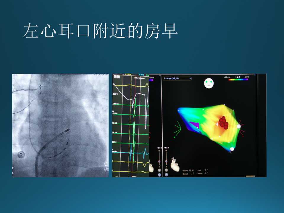 仁济医院射频消融王新华,王新华主要事迹