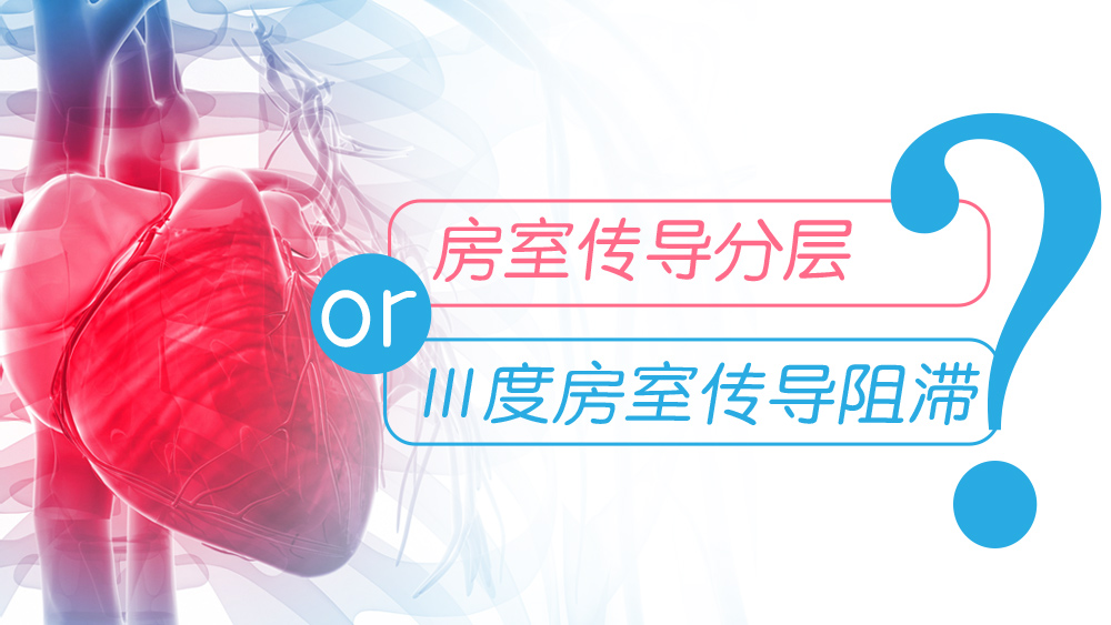 严重的3度房室传导阻滞致死率,iii度房室传导阻滞发病原因