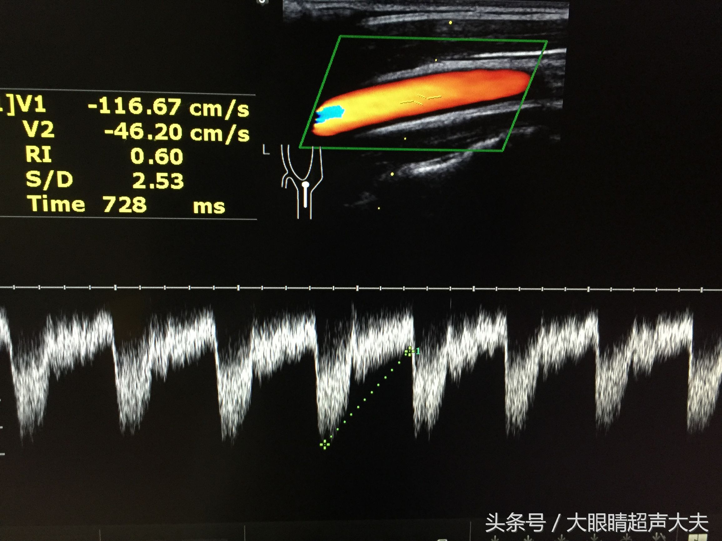 超声检查报告单搞笑图,有趣的超声图