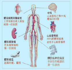 脑出血患者如何预防并发症,护理脑出血病人的方法和技巧