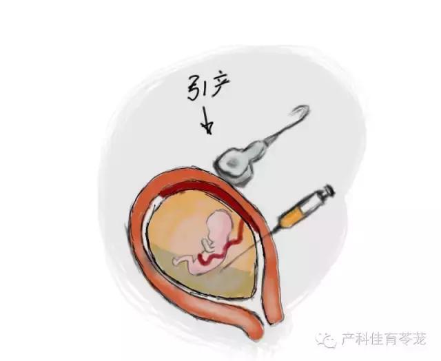 羊水过多和过少的原因,怎么预防羊水过多或过少