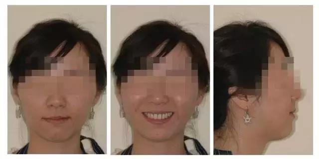 正畸专家介绍图,正畸医生关于整牙的10条建议