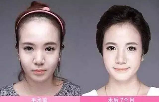 发际线多少适合露额头,露额头才是检验美女的第一标准