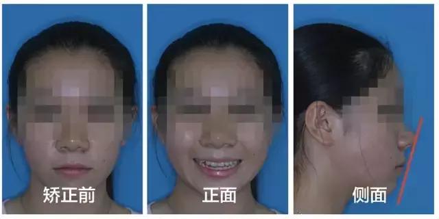 正畸专家介绍图,正畸医生关于整牙的10条建议