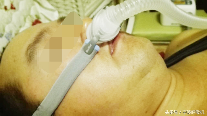 瑞思迈呼吸机面罩,瑞思迈airsense10呼吸机鼻罩