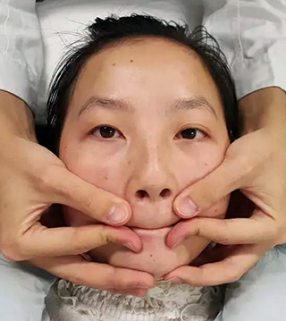 歪嘴改善动作,歪嘴巴治疗方法图片视频播放