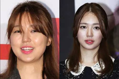 减肥之后脸部变化很大,健身减肥脸型变化