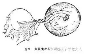 孕期准妈出现腹痛多是这几种原因，种种都很要命！