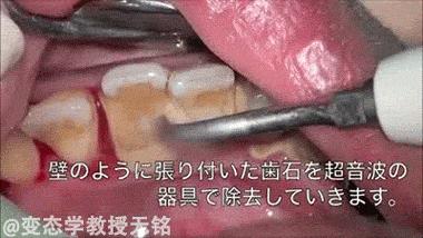 看牙医必问的5个问题,看牙医能快速止痛吗