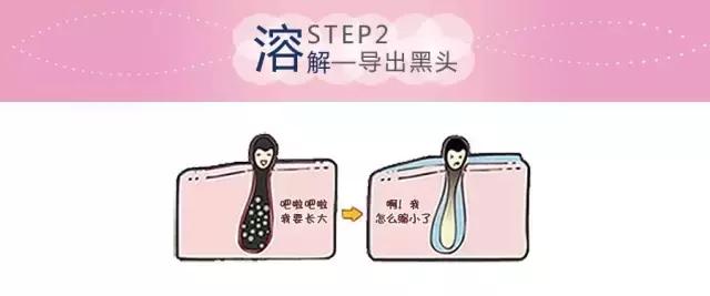 去黑头的方法你真的对了吗,去黑头的最好方法科普