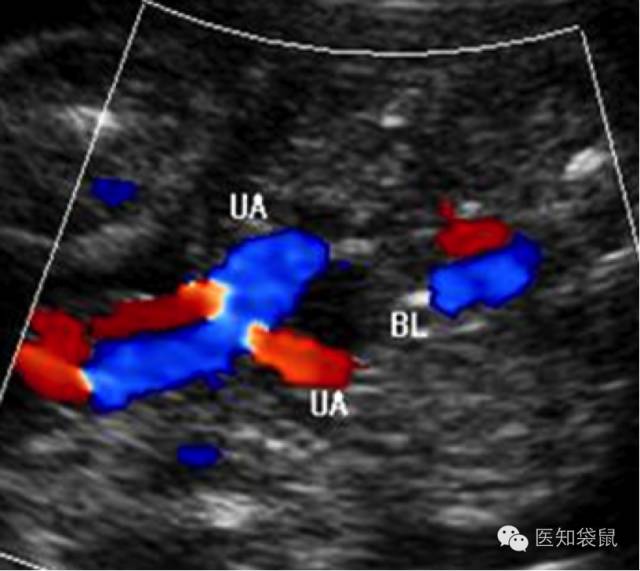 普通b超和肾b超检查范围一样吗,B超三维彩超区别