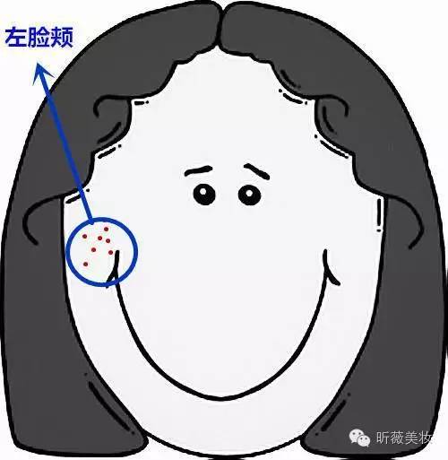 长痘不止青春期全年龄战痘,健康长痘不止青春期全年龄战痘