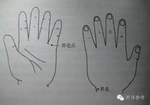 董氏奇穴治疗偏头痛,生小孩神经痛针灸