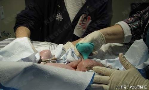 了解分娩的3个过程，新手妈妈们不再对生孩子感到恐慌无措