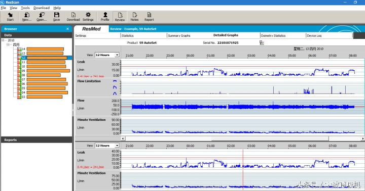 瑞思迈呼吸机真实测评,瑞思迈呼吸机用几年