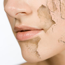 皮肤又干又痒是怎么回事,皮肤干是啥原因怎么治疗