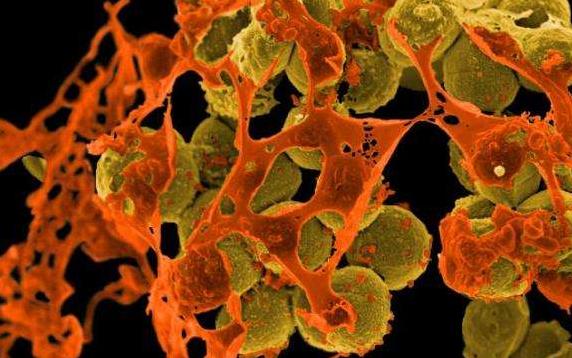 用盐杀硝化细菌吗,万古霉素能杀死金黄色葡萄球菌吗