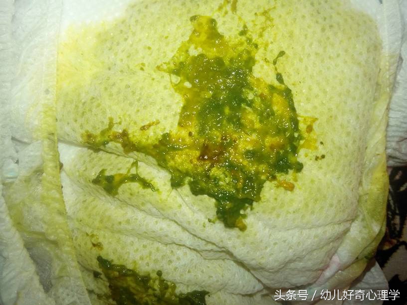 宝宝拉肚子拉灰白色大便怎么办,宝宝拉肚子拉绿便便怎么回事