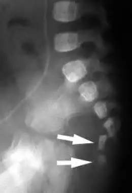 回家路滑倒,回家路上摔了一跤