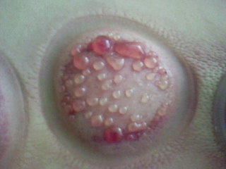 飞鱼菲尔普斯拔罐,飞鱼拔罐