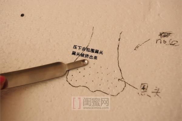 第一次刷酸去黑头新手教程,黑头处理工具用法