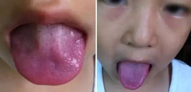 宝宝的舌头正常的图片,小宝宝舌头形态