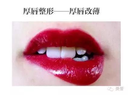 唇唇欲动攻略,唇部拯救你的唇形