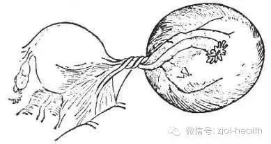 生孩子被切除卵巢,生孩子卵巢切除