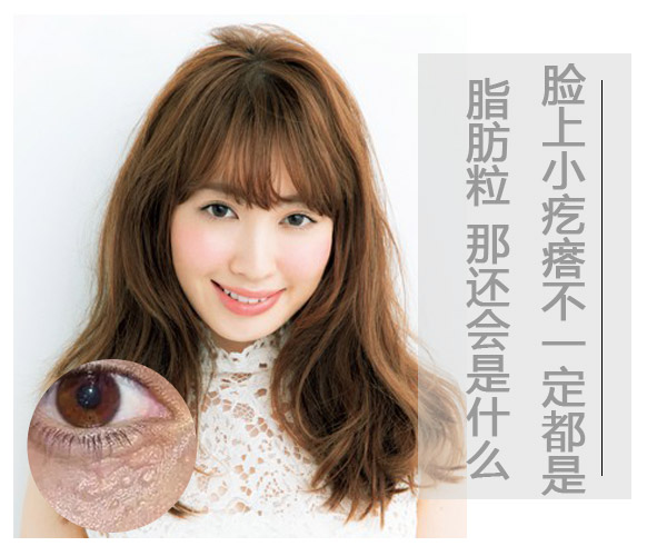 儿童脸上长一粒粒小疙瘩像脂肪粒,脸上类似脂肪粒的疙瘩是什么