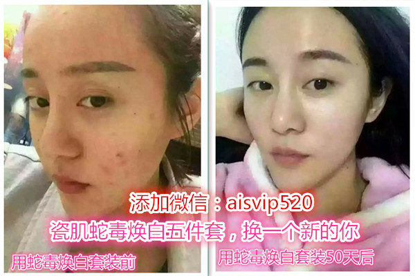 瓷肌祛黄美白面膜,瓷白肌祛斑的正确方法