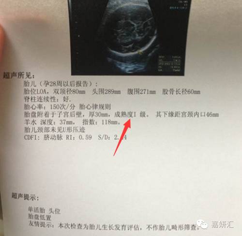 产科b超报告怎么看是否需要清宫,怎么看懂产检b超单