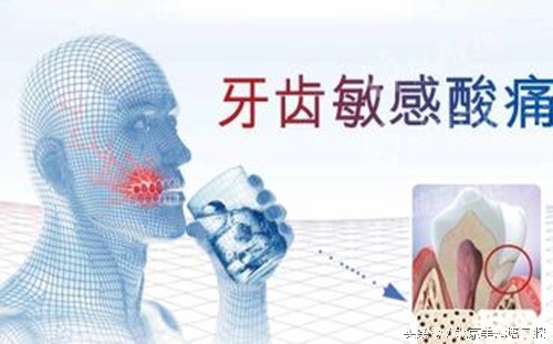 冷热酸甜入口,牙齿酸痛难忍怎么治?