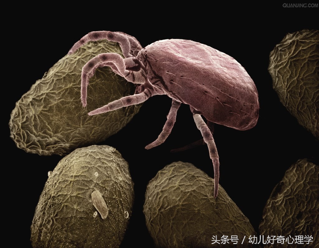 儿童螨虫咬起疙瘩怎么治疗,宝宝身上起螨虫疙瘩怎么办