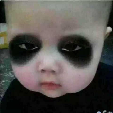 黑眼圈产生原因和去除方法,有几年的黑眼圈如何快速消除