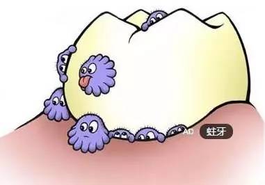 蛀牙怎么才能清洗干净牙科,自己怎么清理牙上的蛀牙