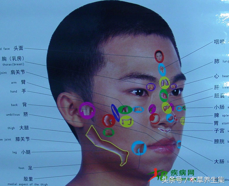 痘痘有响声是怎么回事,痘痘反映的内部问题
