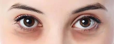 星星眼的小技巧,如何轻松get星星眼